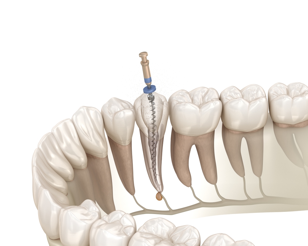 Parkway Dental Parkway Dental