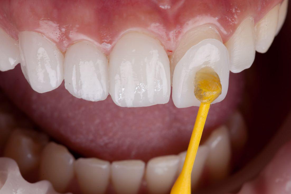 Parkway Dental Parkway Dental